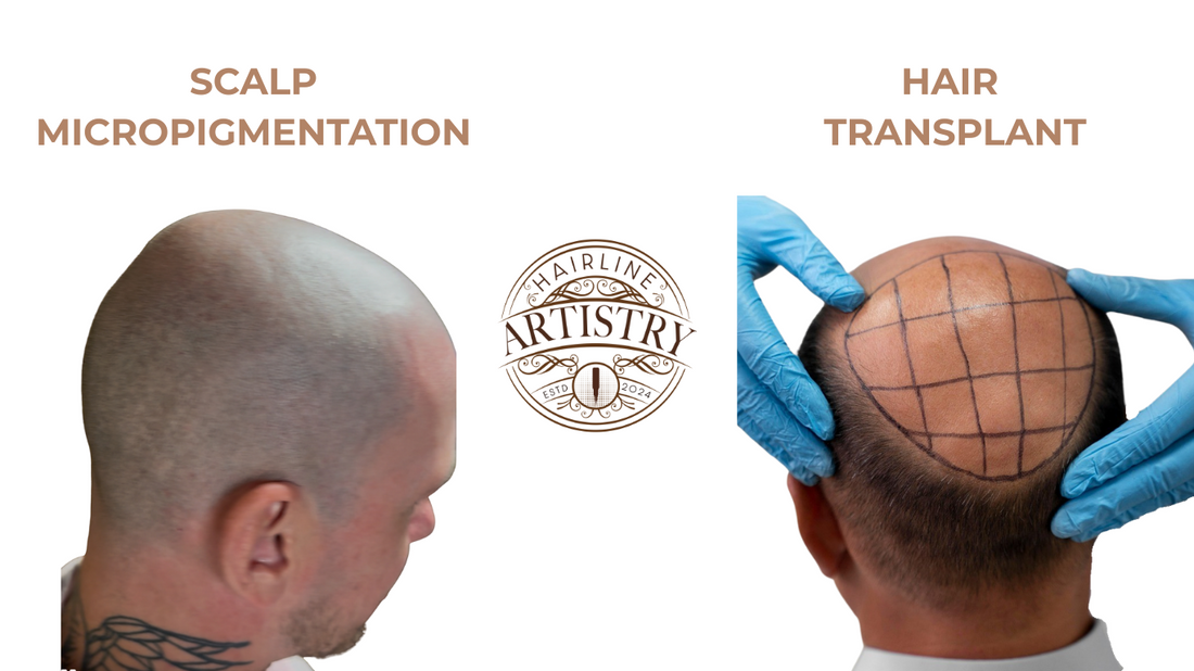 Scalp micropigmentation vs hair transplant comparison