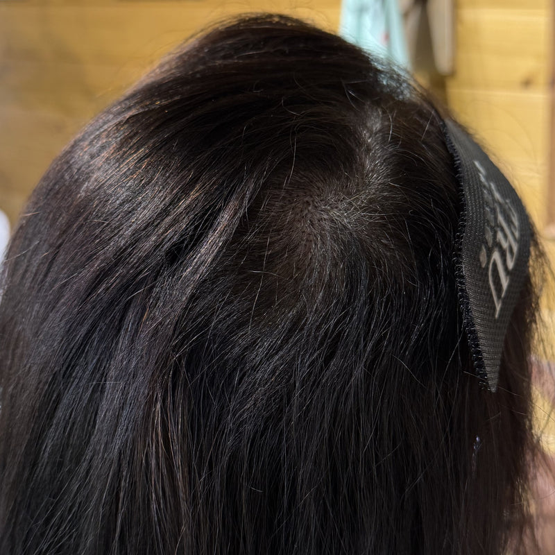 Top view of female crown after scalp micropigmentation showing fuller appearance and improved hair density around the crown area