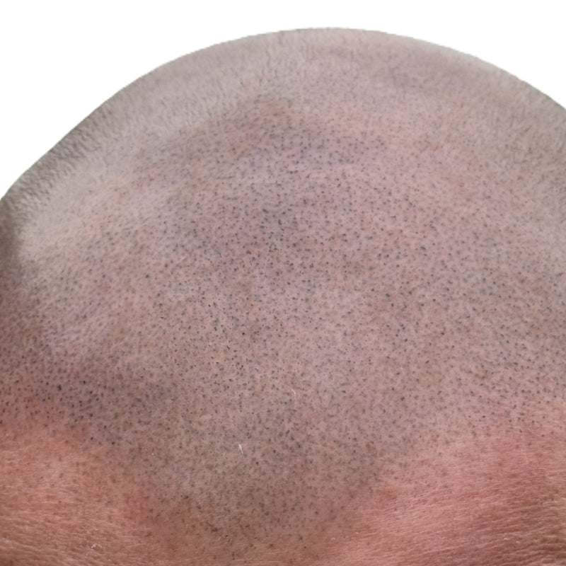 Close up of a scalp showing scalp micropigmentation dots creating natural hair density effect