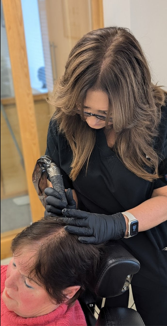 Scalp micropigmentation treatment in progress